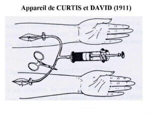 Appareil de Curtis et David